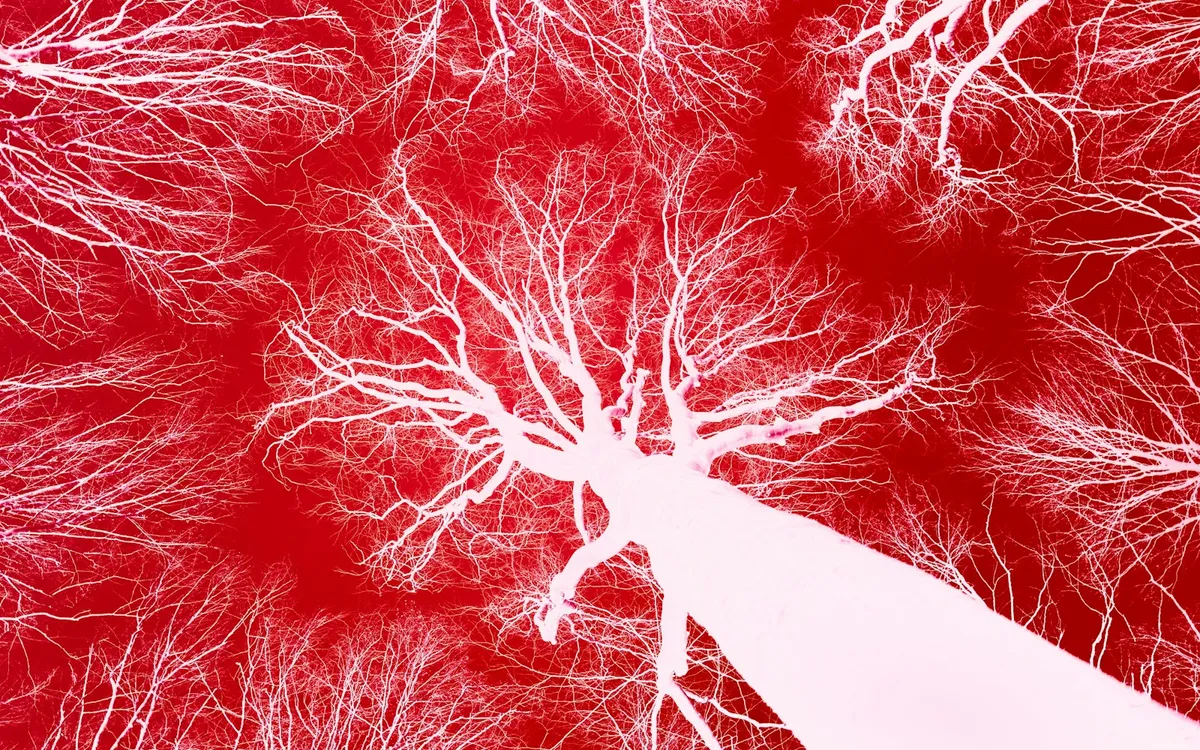 脳血管